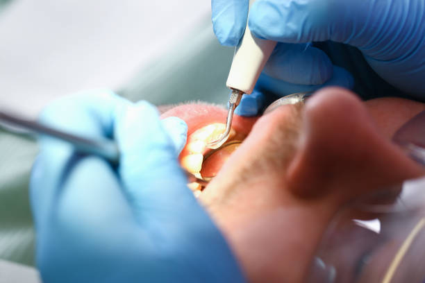 Best Weekend Emergency Dentist in Marshall, MN