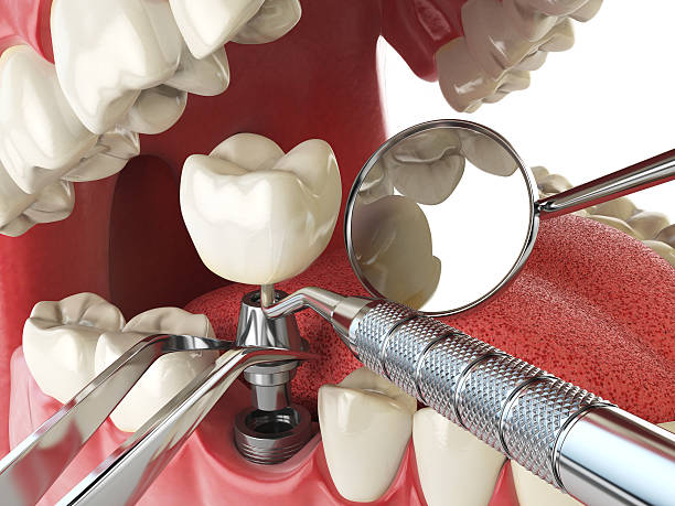 Best Pediatric Emergency Dentist in Marshall, MN